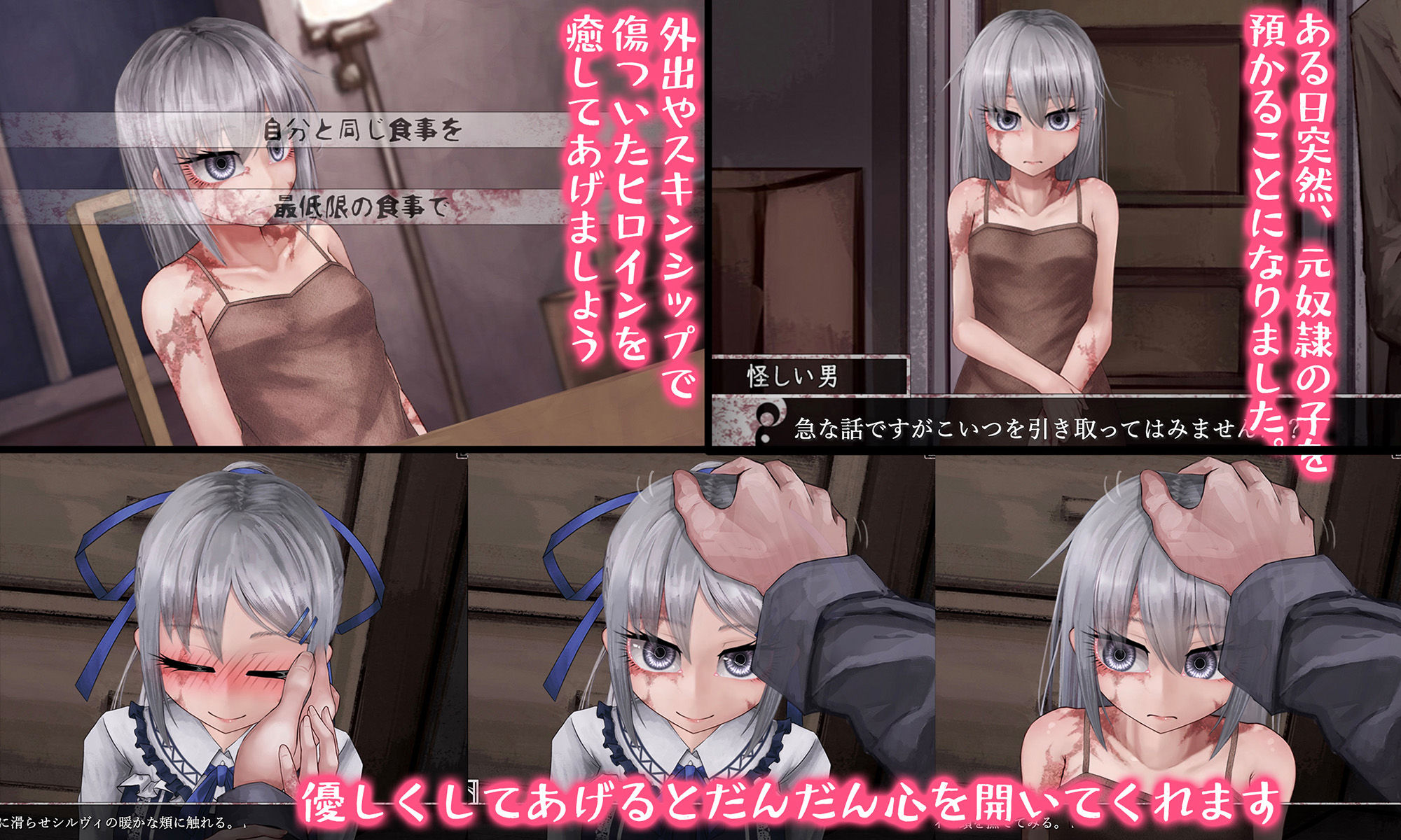 Teaching Feeling -傷肌少女との生活- 画像1
